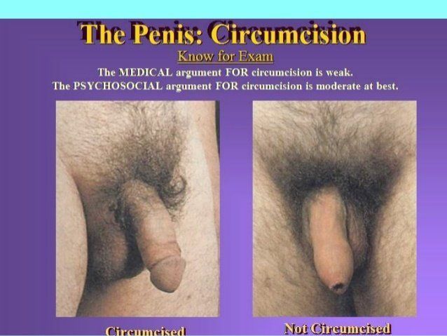 Circumcised cock best adult free images.