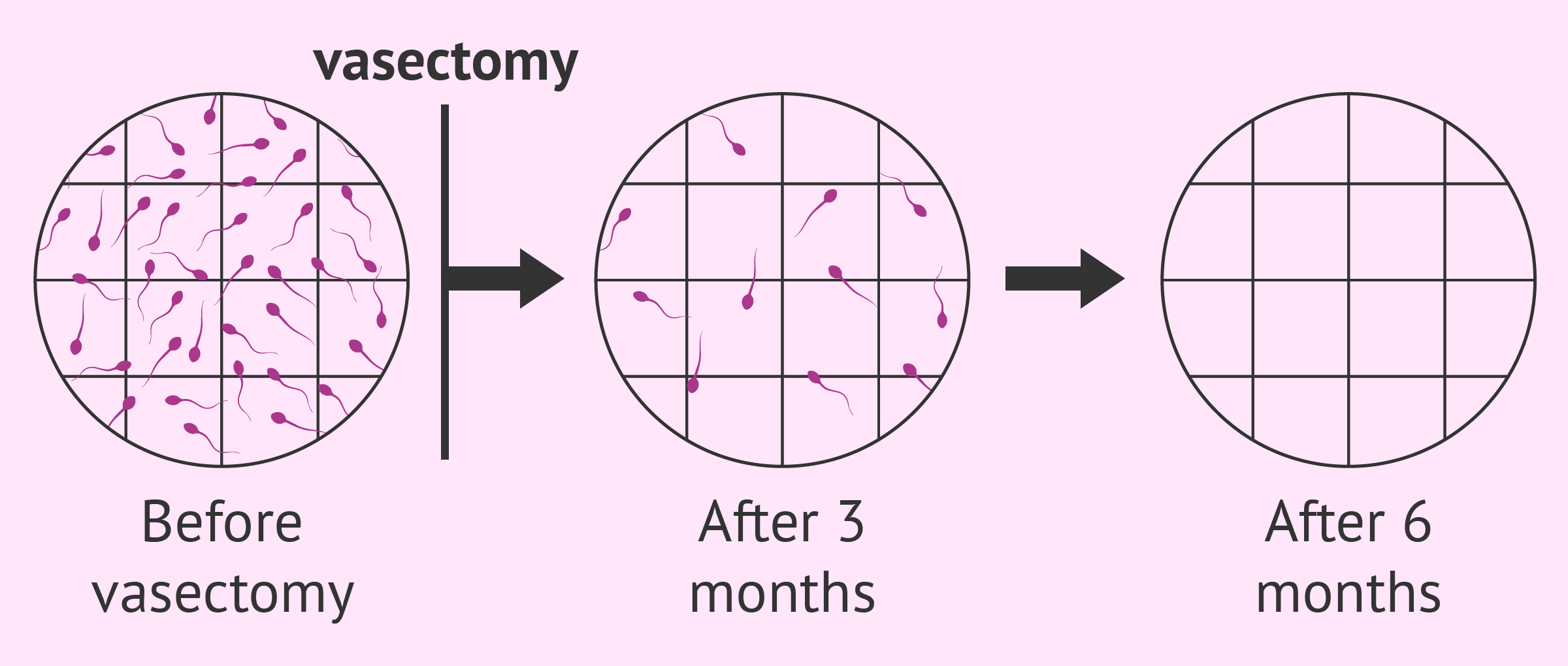 best of Viability vasectomy Sperm after