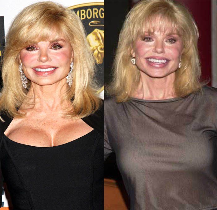 Ginger reccomend Loni anderson new recent