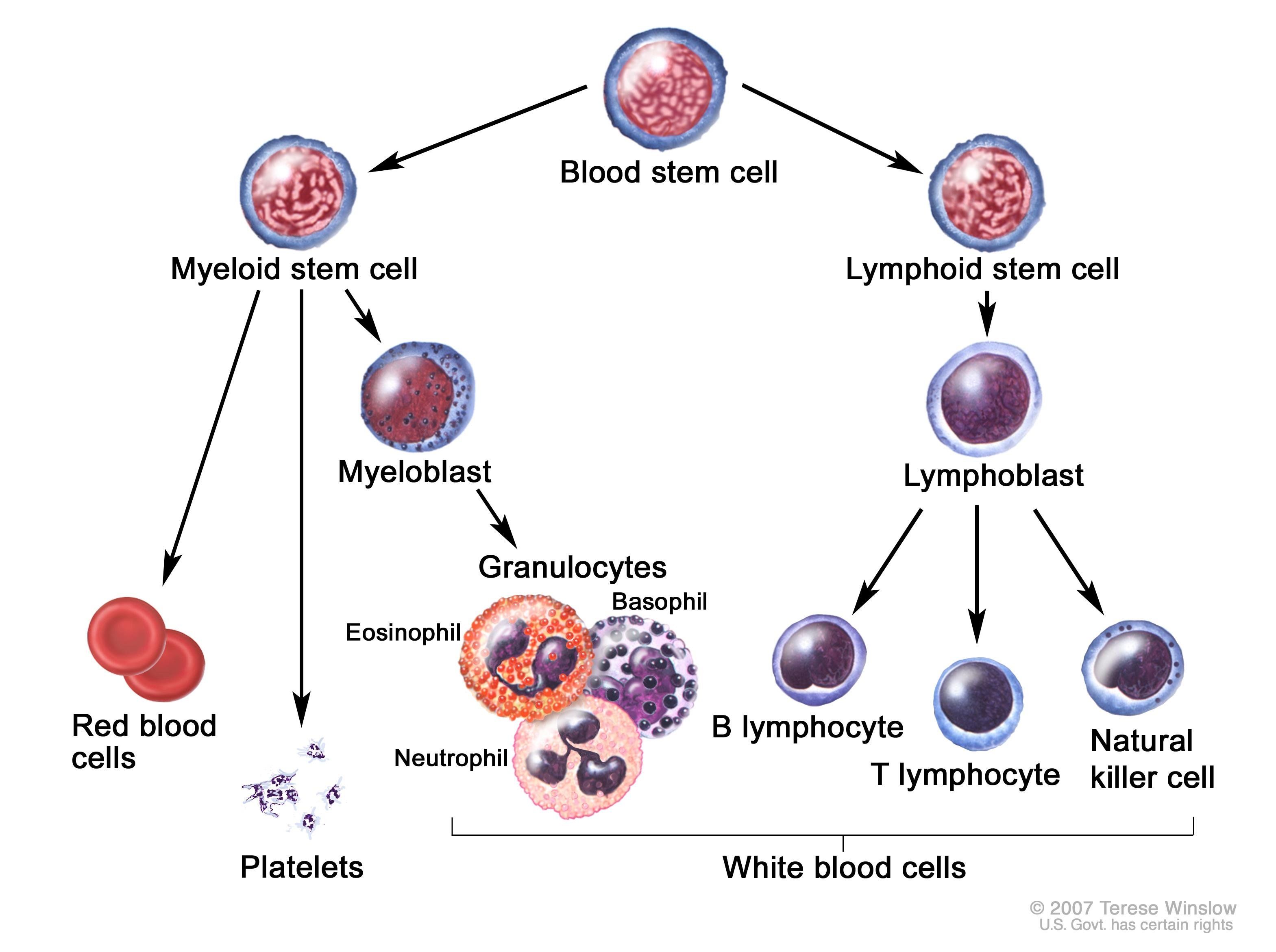 Malignant tumor of mature lymphocytes