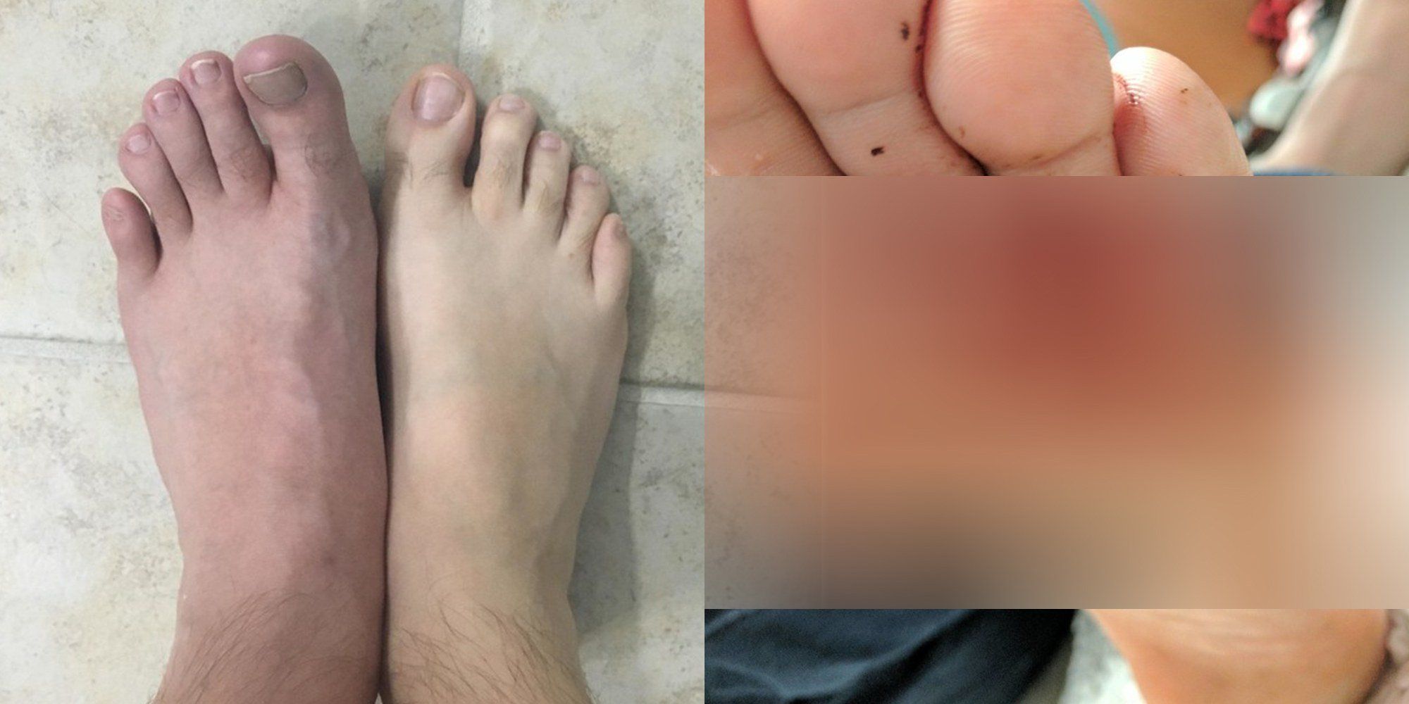 Golden G. reccomend Mature feet stink story