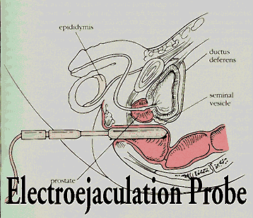 Electric orgasm ejaculation