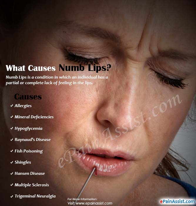 Venom reccomend Facial numbness fibromyalgia