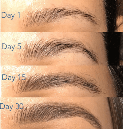 best of Regrowth Shaved eyebrow