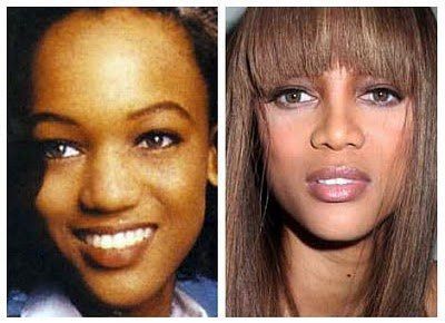 Tyra banks boobs Plastic Surgery Before And After: Tyra Banks