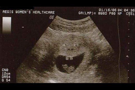 best of Funny pictures Ultrasound