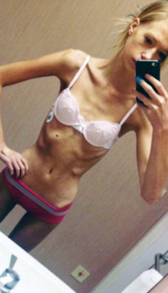 Sexy anorexic babe