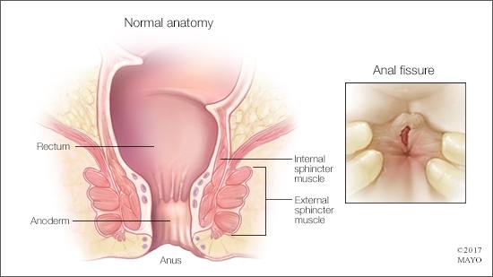 Human anal area picture