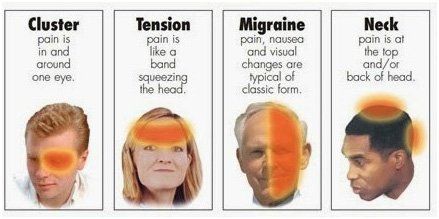 best of Pain with facial Chronic headaches