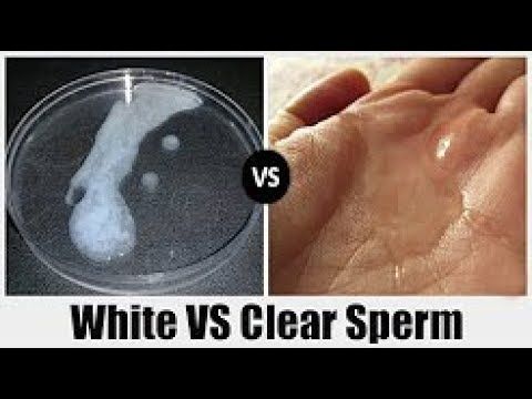 Is clear sperm normal