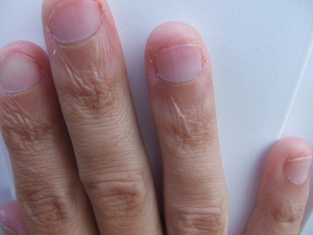 High T. reccomend Fetish of bitten nail