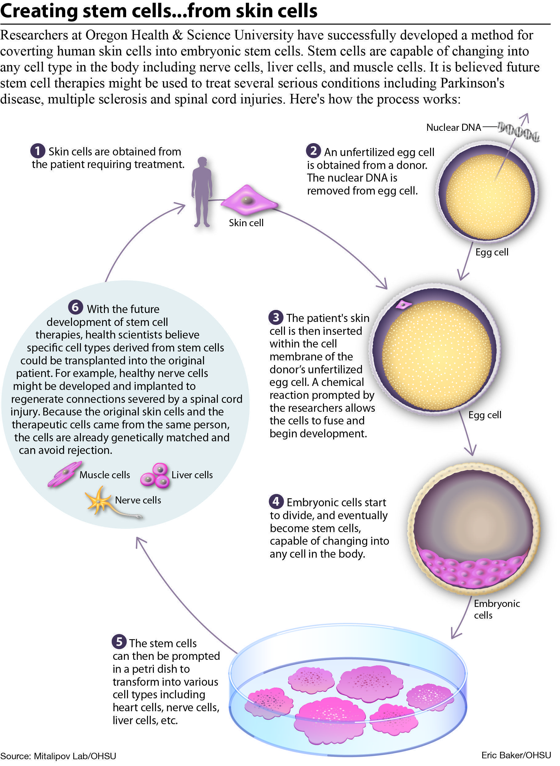 Making sperm from stem cells