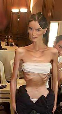 Ice reccomend Super skinny anorexic teen