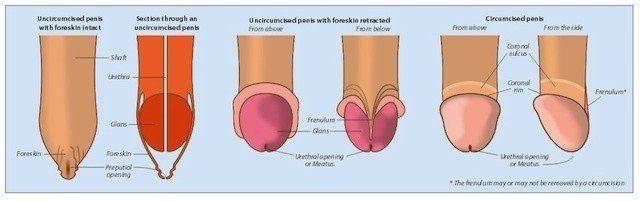 Circumcised penis vs uncircumcised