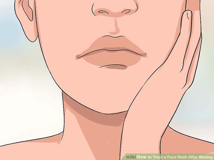Facial waxing irritation causes