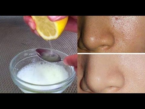Cleaning and closing facial pores