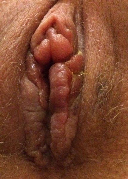 best of Pic Swollen clitoris