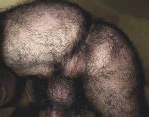 Hairy butts and holes
