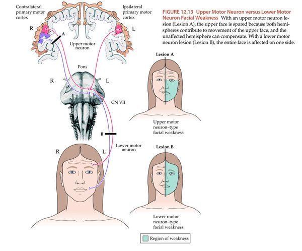 Wonka reccomend Lower motor neuron facial