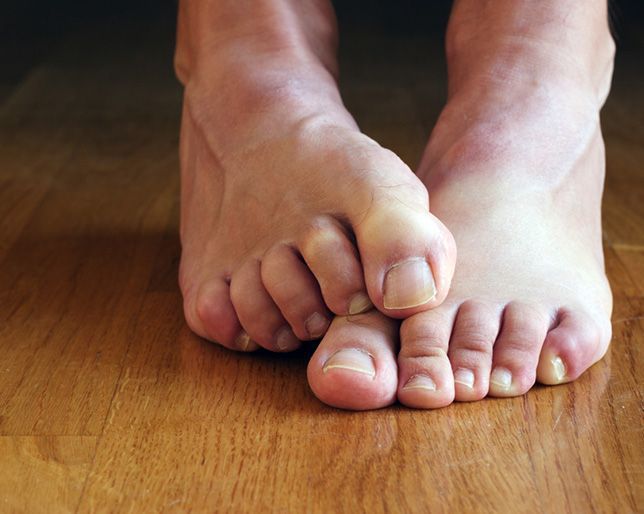 Mature feet stink story