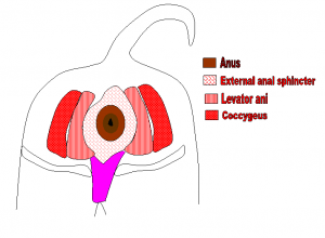 best of Gland Perineal hernia anal