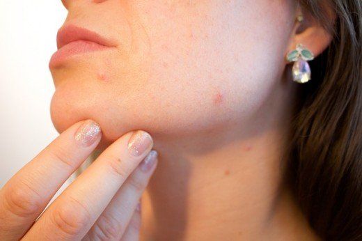 Pregnancy and facial rashes
