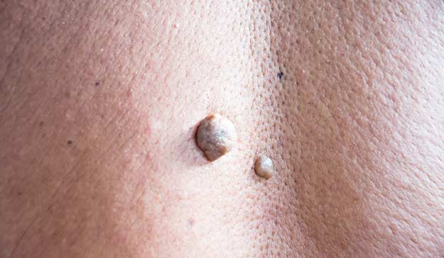 best of The Small on skin anus tags