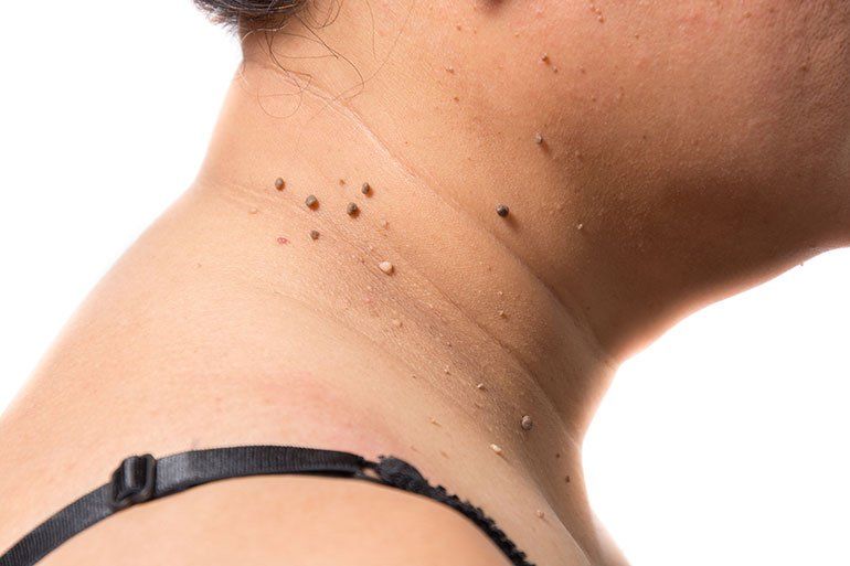 best of The Small on skin anus tags