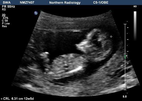 best of Funny pictures Ultrasound